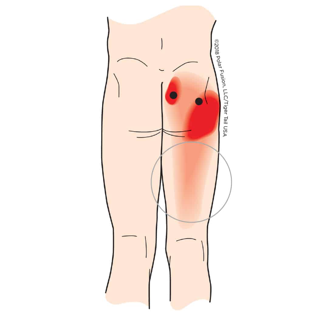 MuscleEducation_Piriformis_6-2