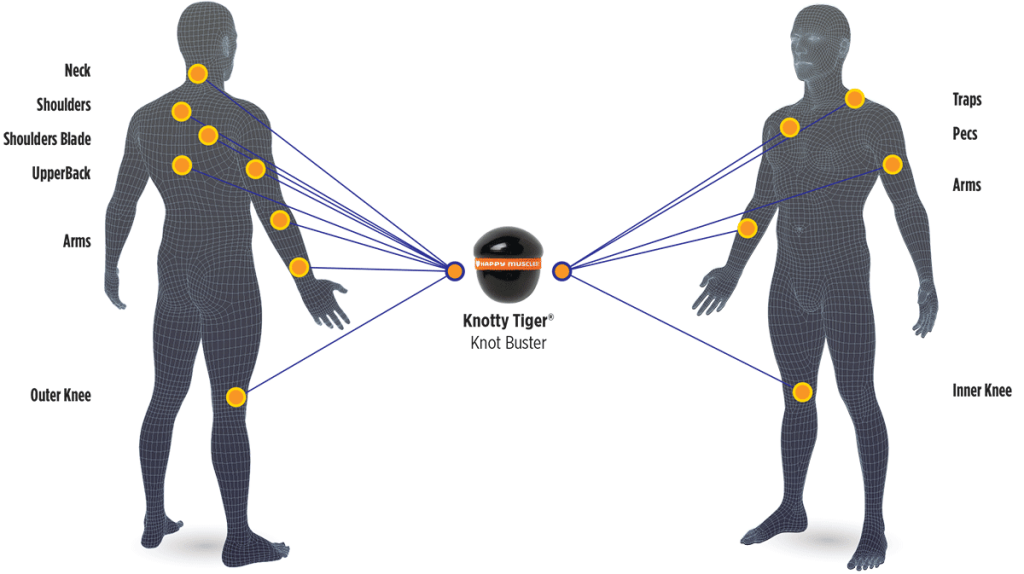 Knotty Tiger Knot Buster Body Map Application