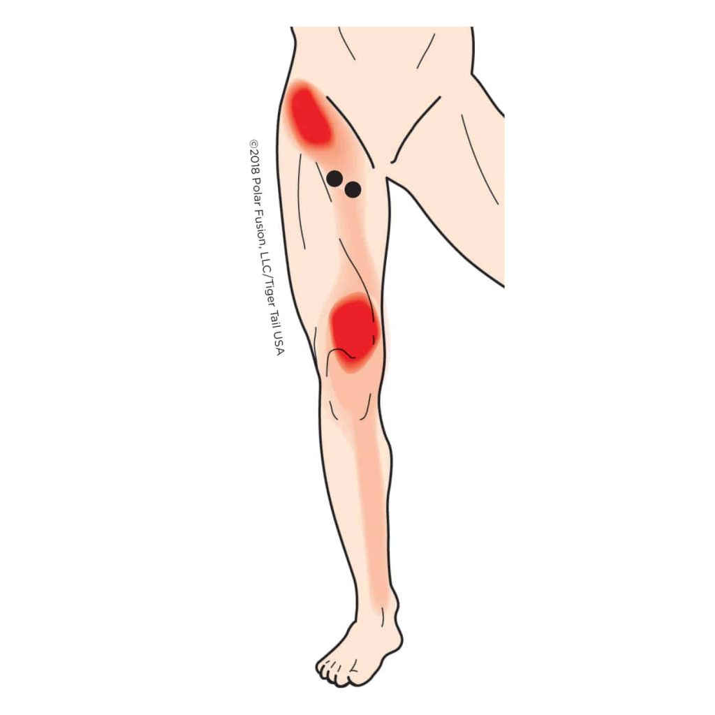 MuscleEducation_AdductorBrevisLongus_1-8