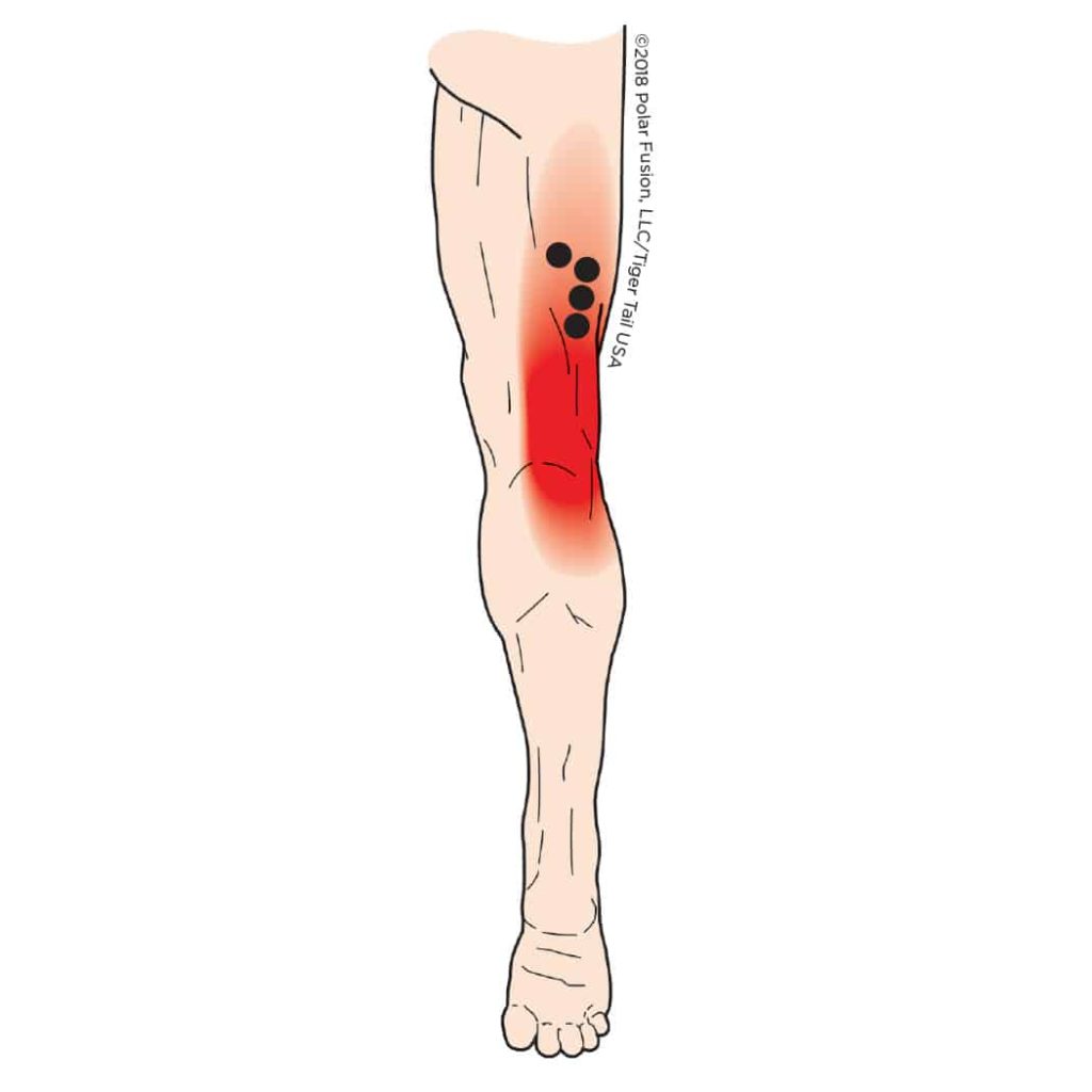 MuscleEducation_BicepsFemoris_6-3