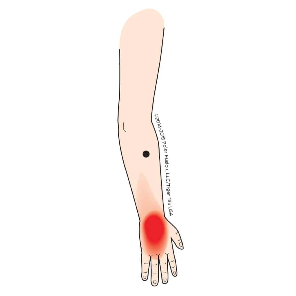 MuscleEducation_ExtensorCarpiBrevis_17-2