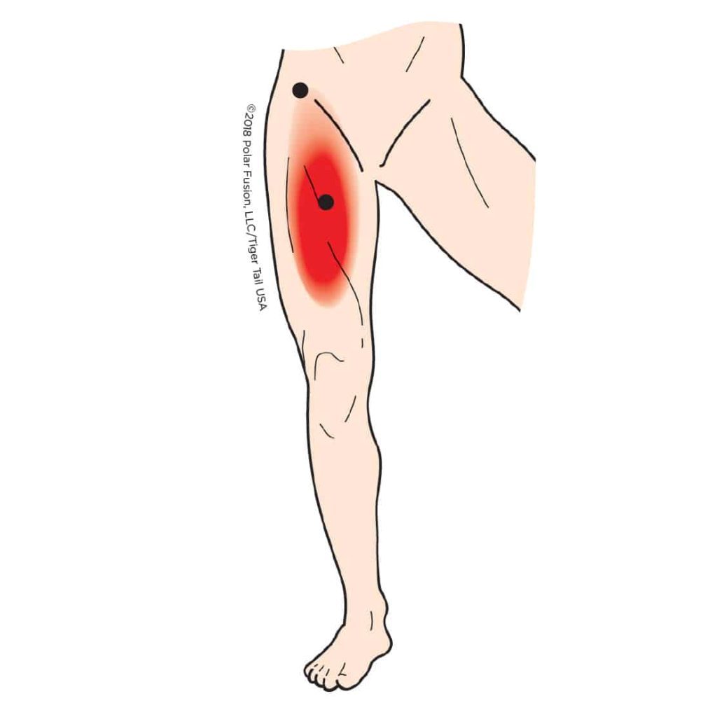 MuscleEducation_Iliopsoas_2-1-1