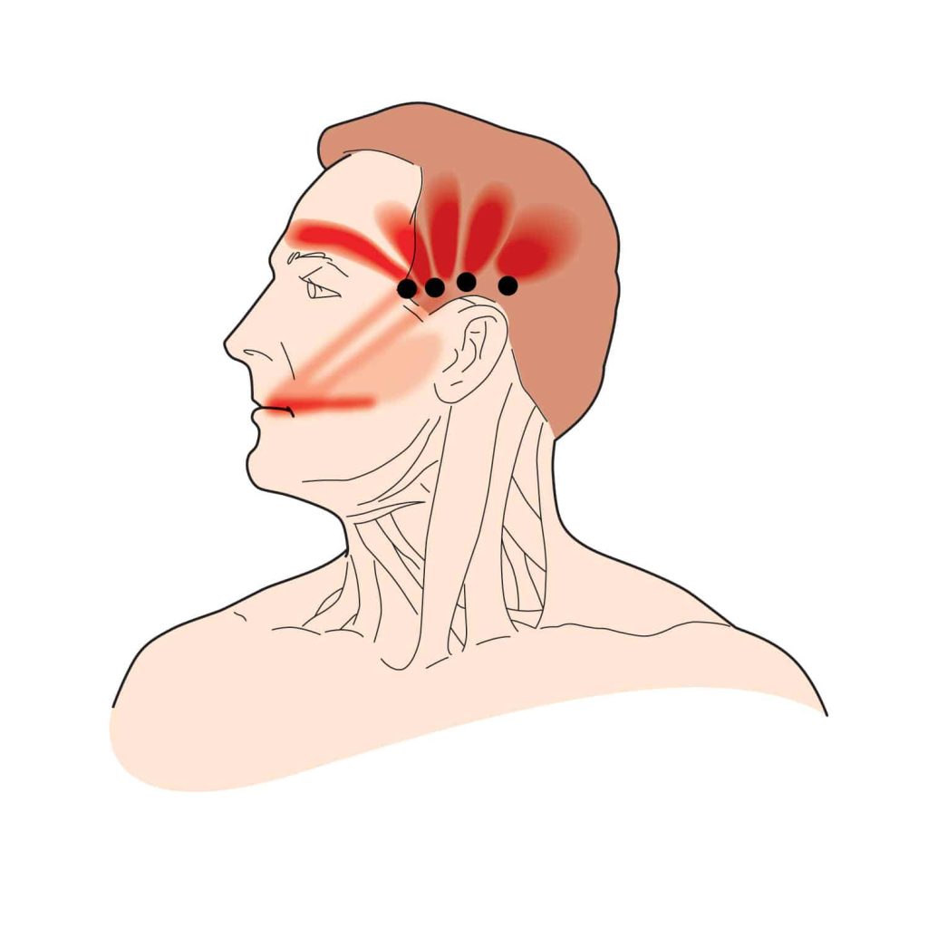 MuscleEducation_img_HSMK_02