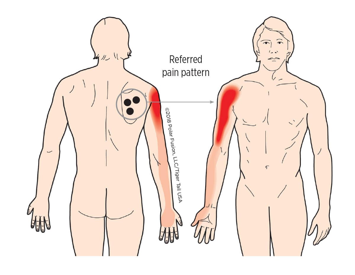 MuscleEducation_Infraspinatus_16-12