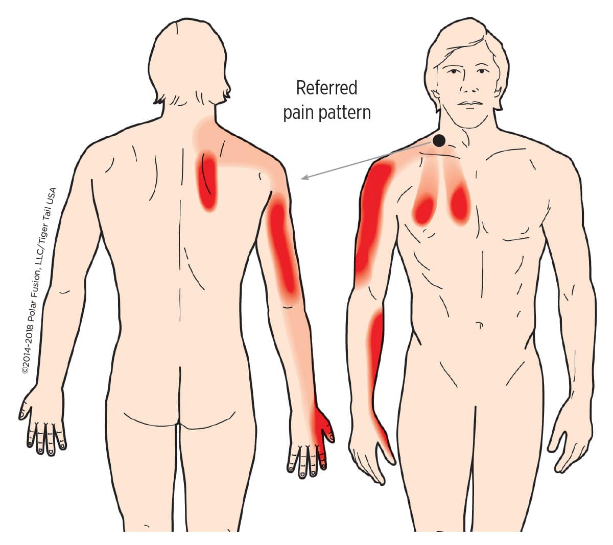 MuscleEducation_Scaleni_17-20