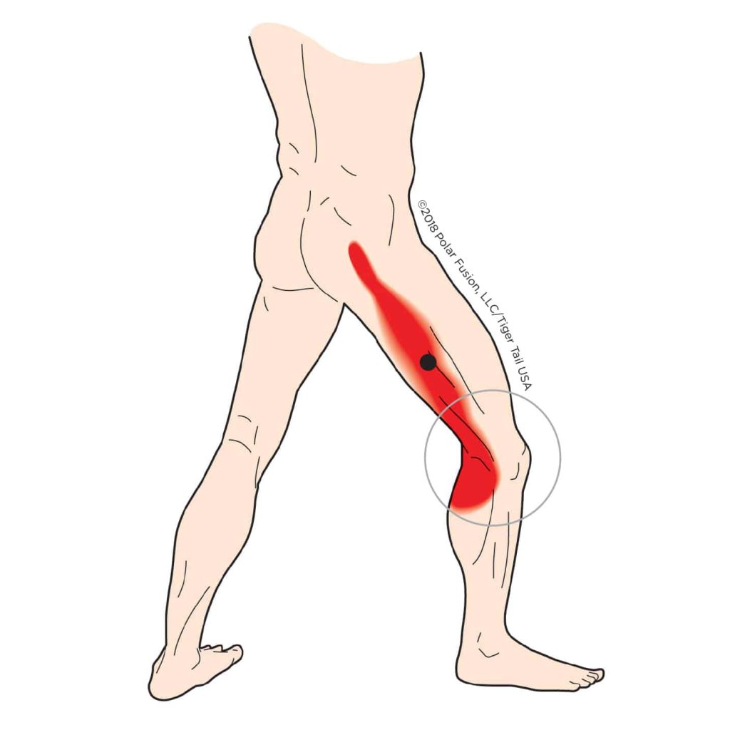 MuscleEducation_VastusLateralis_1-1