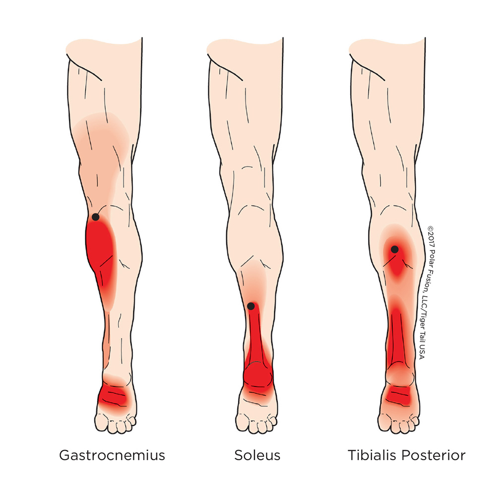 Pain in the heel and bottom of the foot can often be traced back to muscles in the lower leg. These muscles can develop knots, which are localized areas of tight muscle fibers. These knots can cause pain not only where they are located but also refer pain to other areas, including the heel and bottom of the foot.