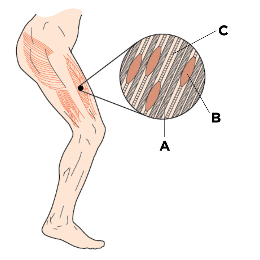 Muscle knots, also known as myofascial trigger points, are tight, painful areas in muscles. They can cause discomfort, stiffness, and reduced range of motion.