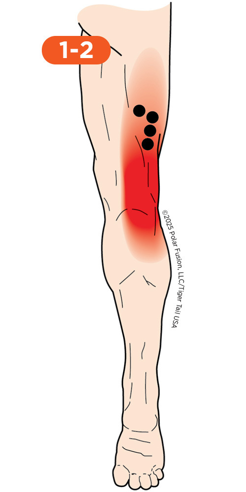 Knee_Back_1-2_BicepsFemoris_500px Back of Knee Pain 1-2 Biceps Femoris