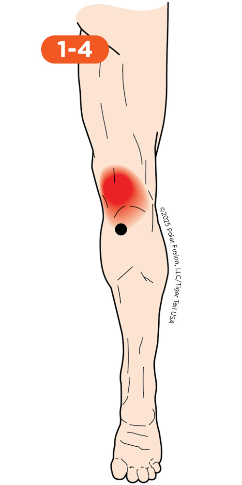 Knee_Back_1-4_Popliteus_500px_2 Back of Knee Pain 1-4 Popliteus