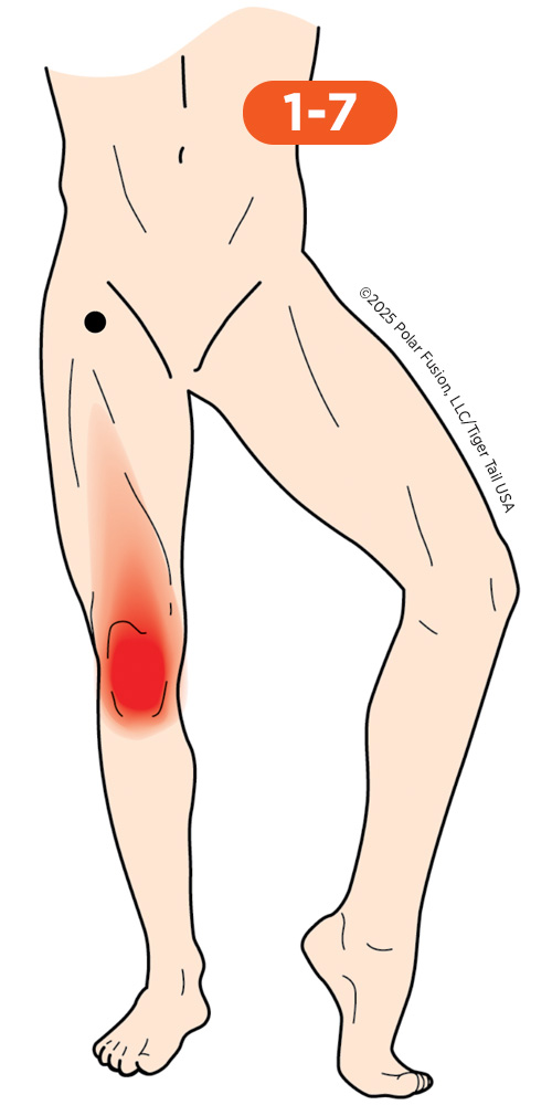 Front of Knee Pain 1-7 Rectus Femoris