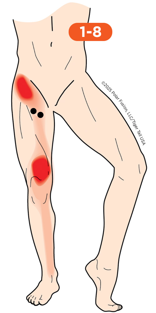 Knee_Front_1-8_AdductorBrevisAdductorLongus_500px Front of Knee Pain Front 1-8 Adductor Brevis Adductor Longus