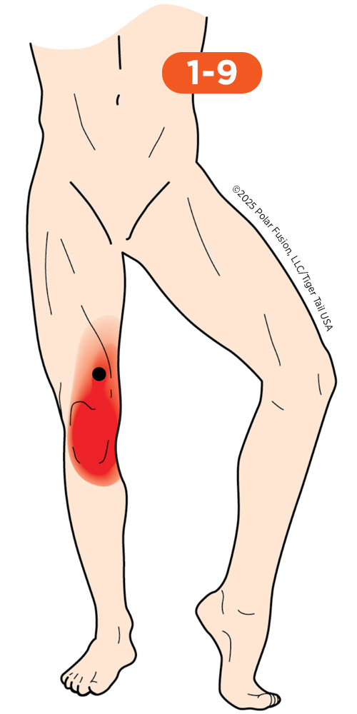 Knee_Front_1-9_VastusMedialisOblique_500px Front of Knee Pain 1-9 Vastus Medialis Oblique