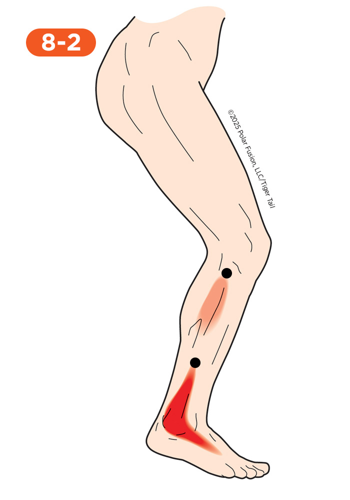Ankle Pain 8-2 Peroneus Longus (Upper) Brevis (Lower)