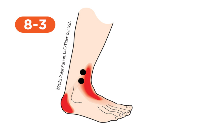 Ankle Pain 8-3 Peroneus Tertius