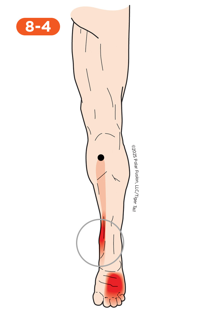 Ankle Pain 8-4 Flexor Digitorum Longus