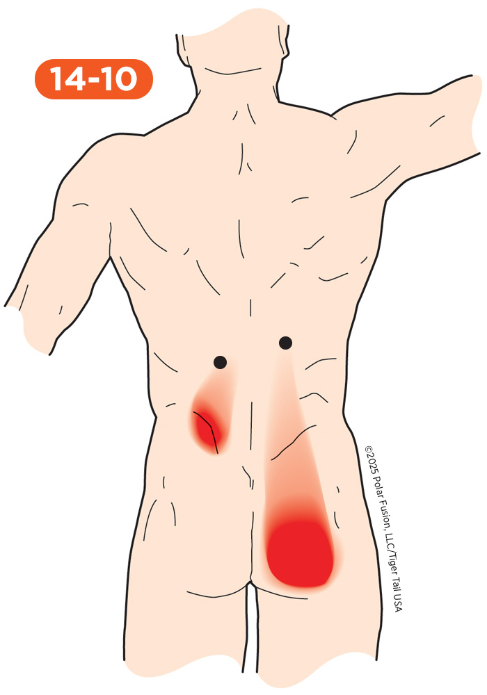 Back Pain 14-10 Longissimus Thoracis