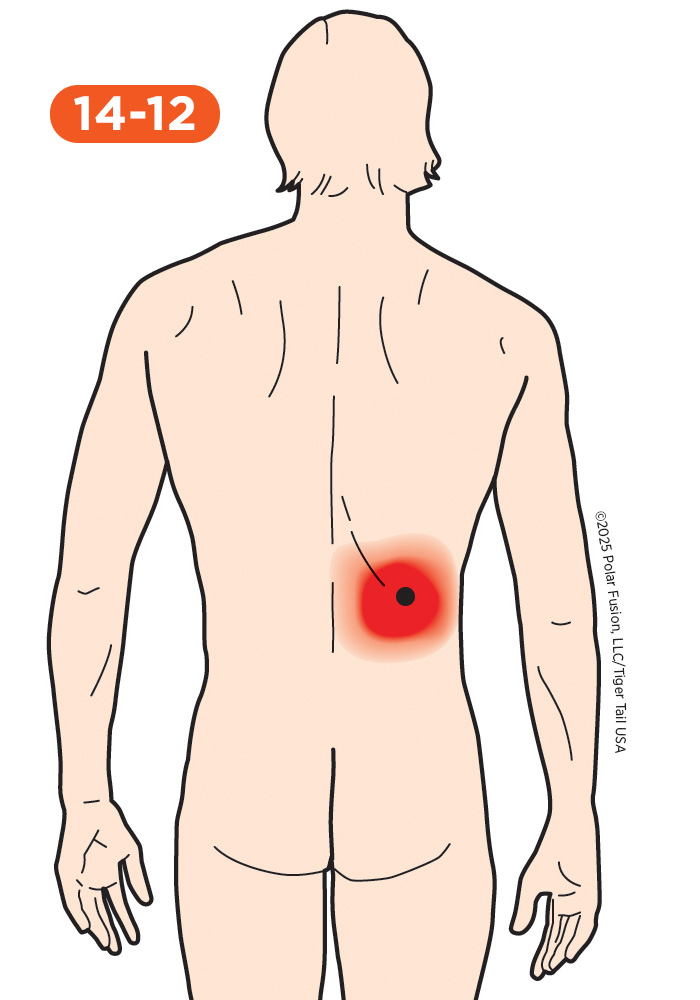 Back Pain 14-12 Serratus Posterior Inferior