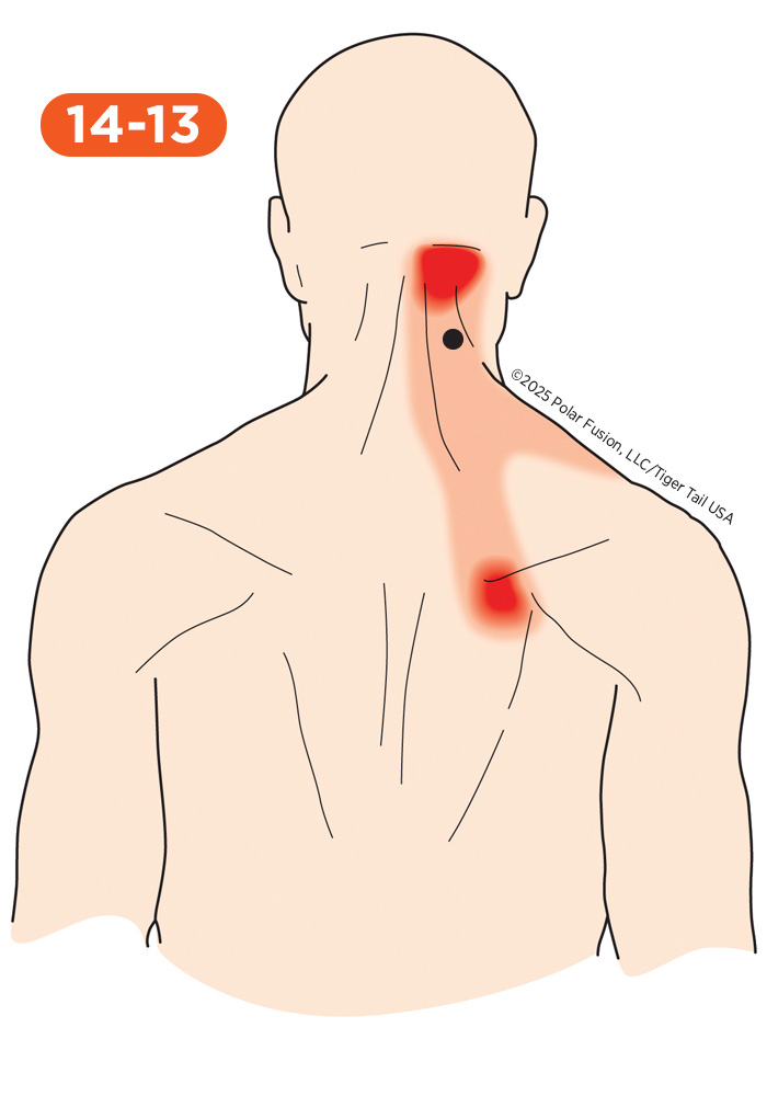 Back Pain 14-13 Cervical Multifidi