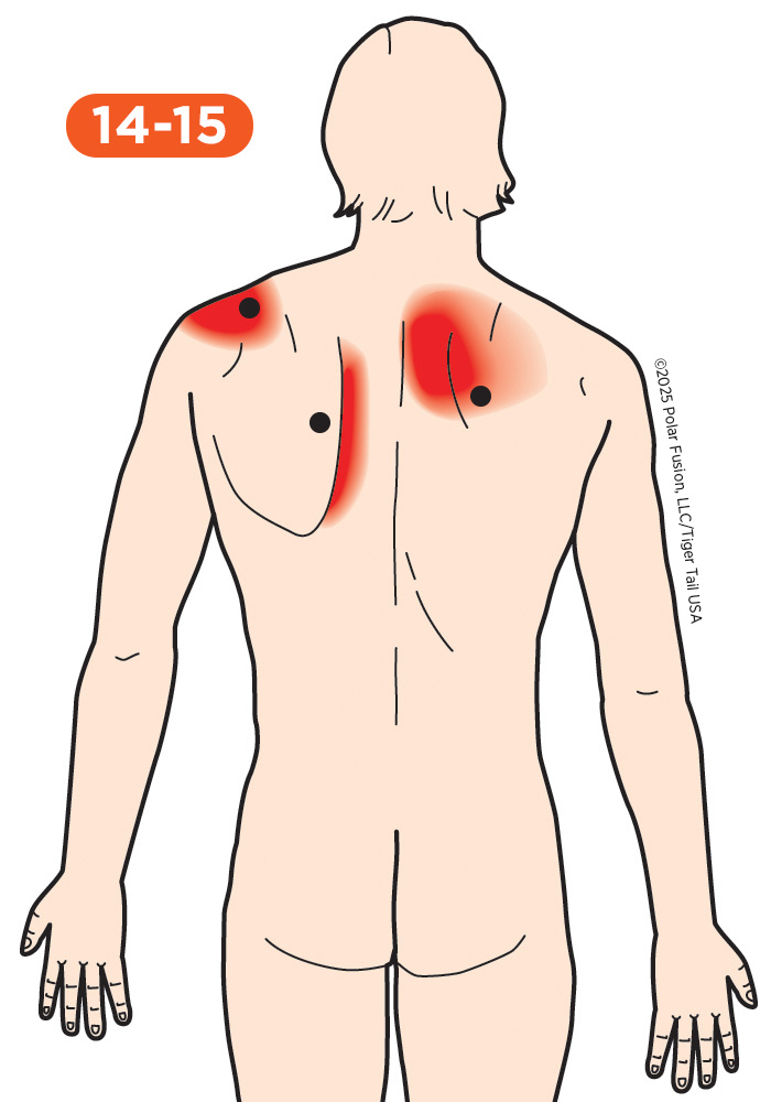 Back Pain 14-15 Trapezius