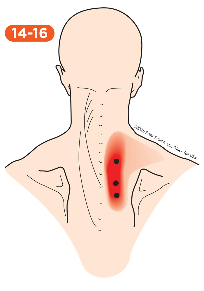 Back Pain 14-16 Rhomboideus