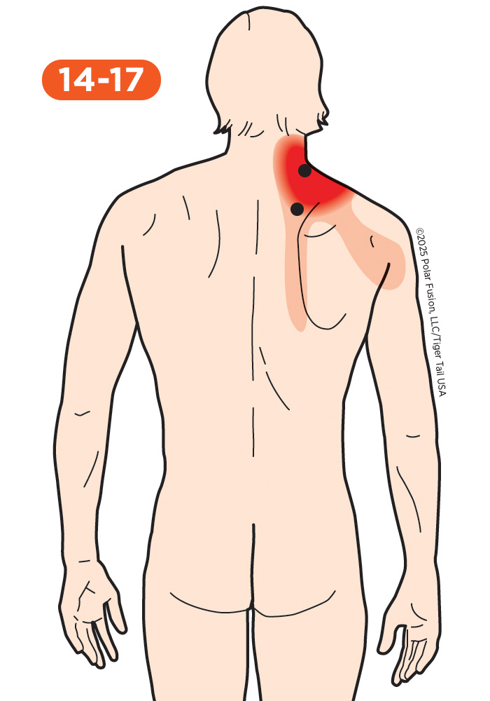 Back Pain 14-17 Levator Scapulae