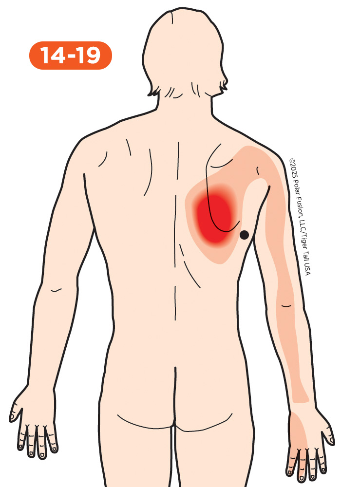 Back Pain 14-19 Latissimus Dorsi