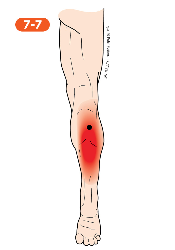 Calf Pain 7-7 Soleus