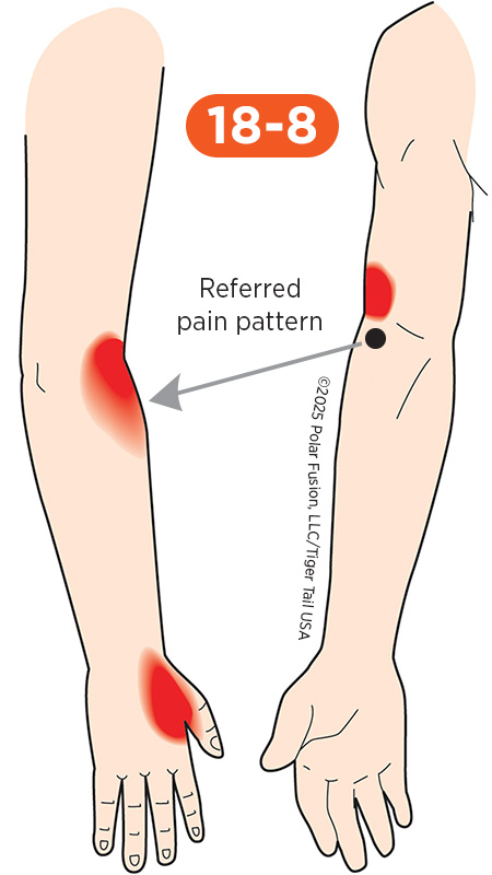Elbow Pain 18-8 Supinator