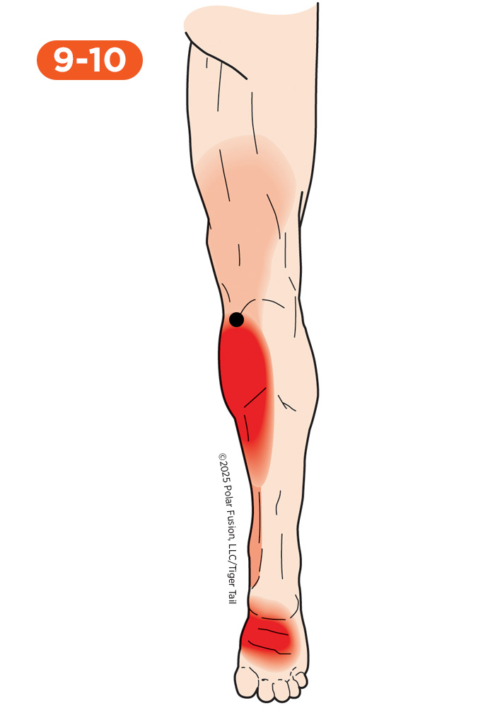 Foot and Toe Pain 9-10 Gastrocnemius