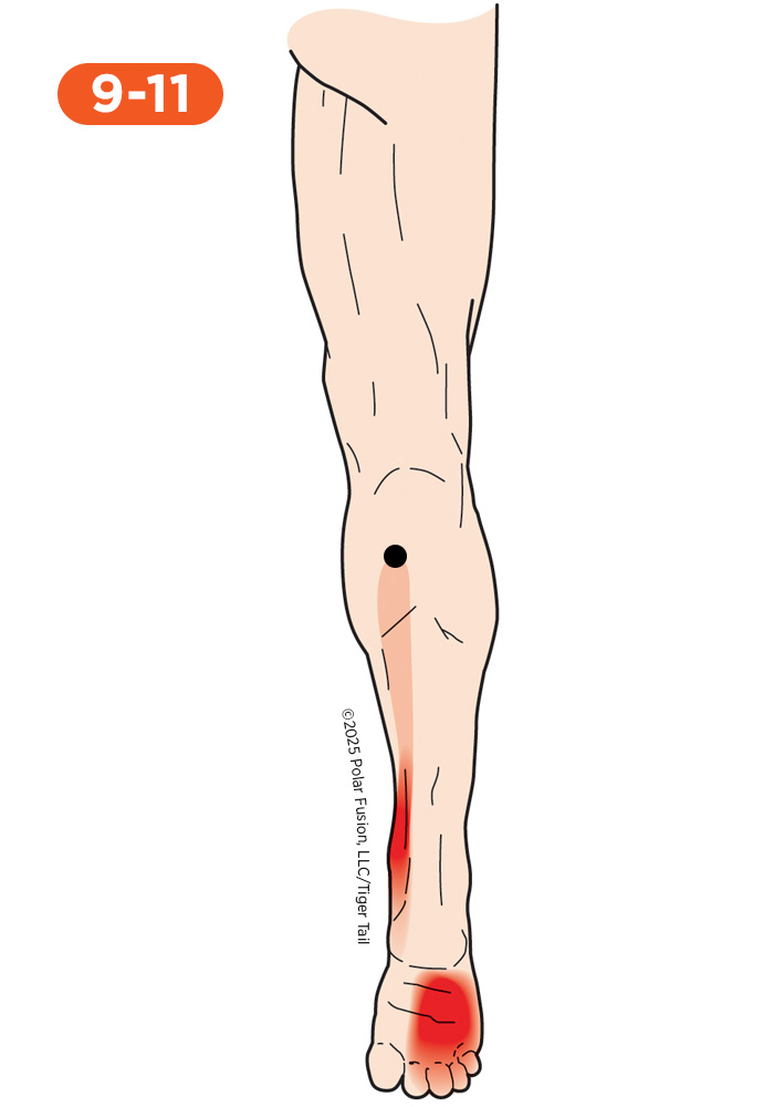 Foot and Toe Pain 9-11 Flexor Digitorum Longus