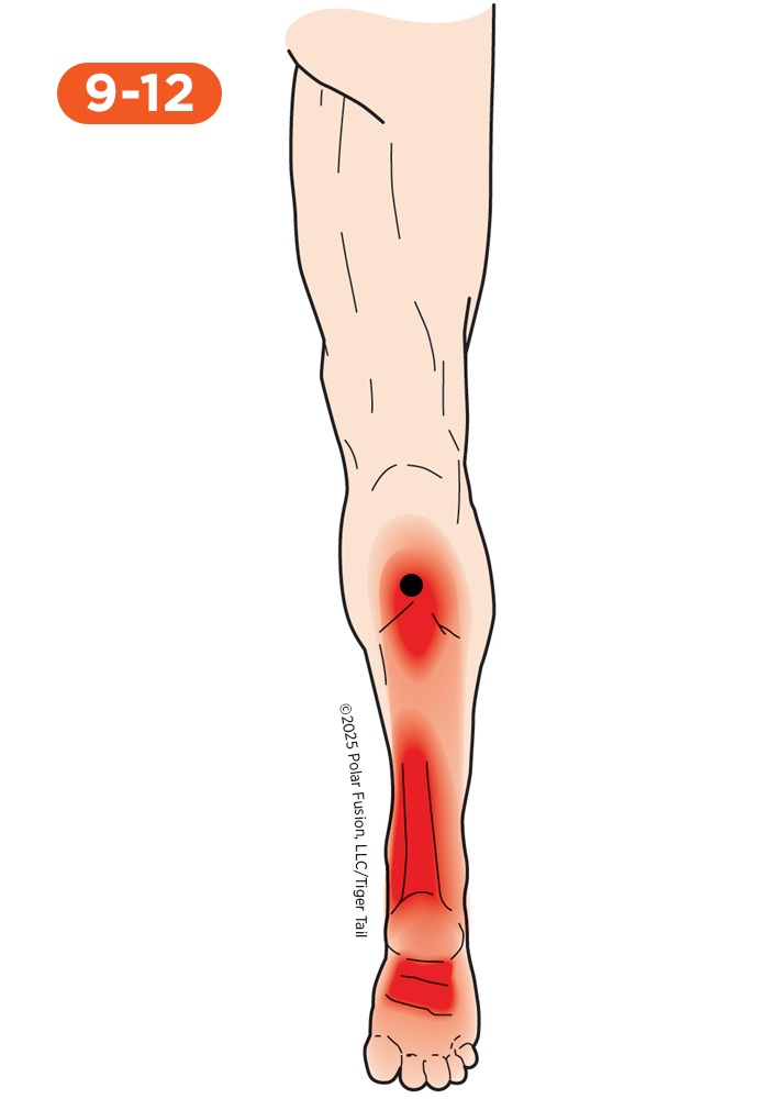 Foot and Toe Pain 9-12 Tibialis Posterior