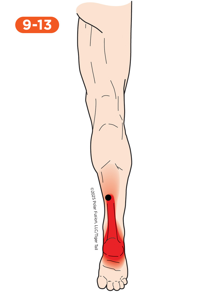 Foot and Toe Pain 9-13 Soleus