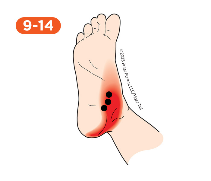 Foot and Toe Pain 9-14 Abductor Hallucis
