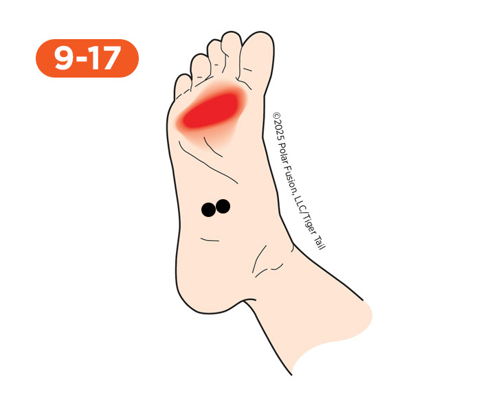 Foot and Toe Pain 9-17 Flexor Digitorum Brevis