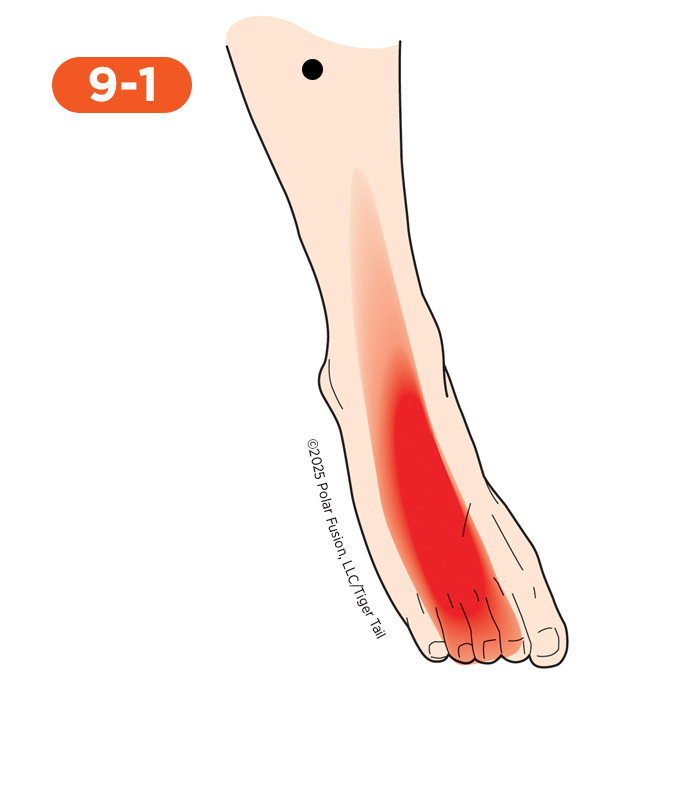 Foot and Toe Pain 9-1 Extensor Digitorum Longus