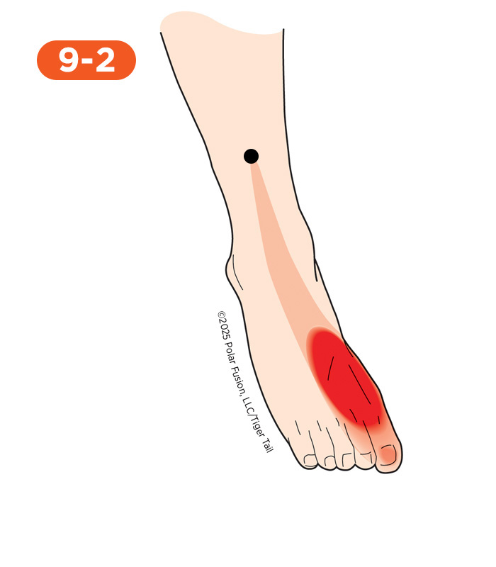 Foot and Toe Pain 9-2 Extensor Hallucis Longus