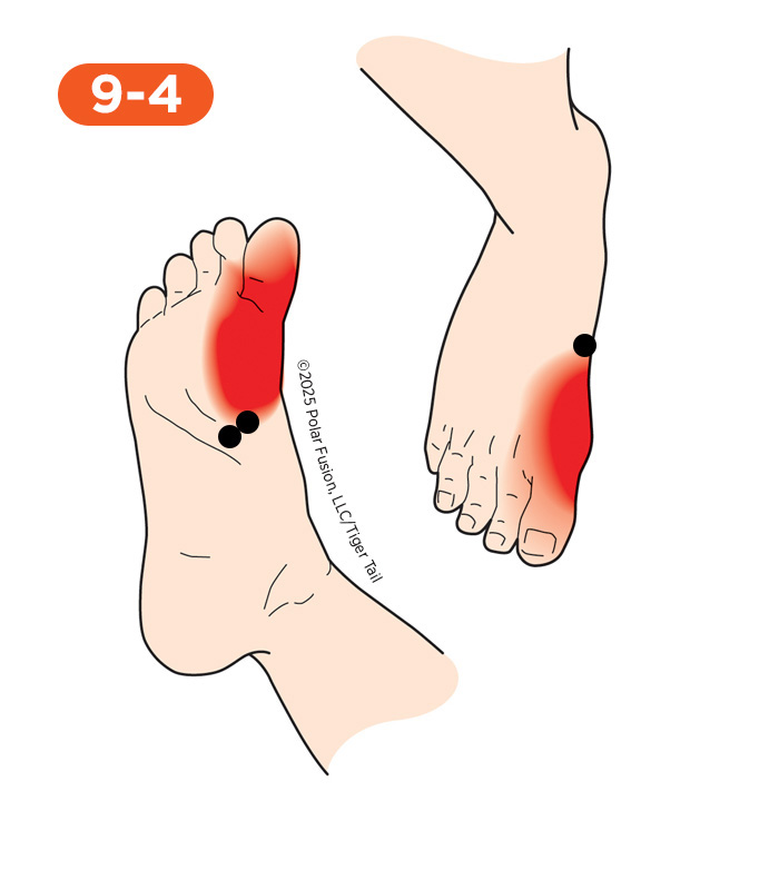 Foot and Toe Pain 9-4 Flexor Hallucis Brevis