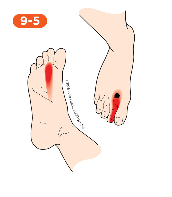 Foot and Toe Pain 9-5 First Dorsal Interosseous