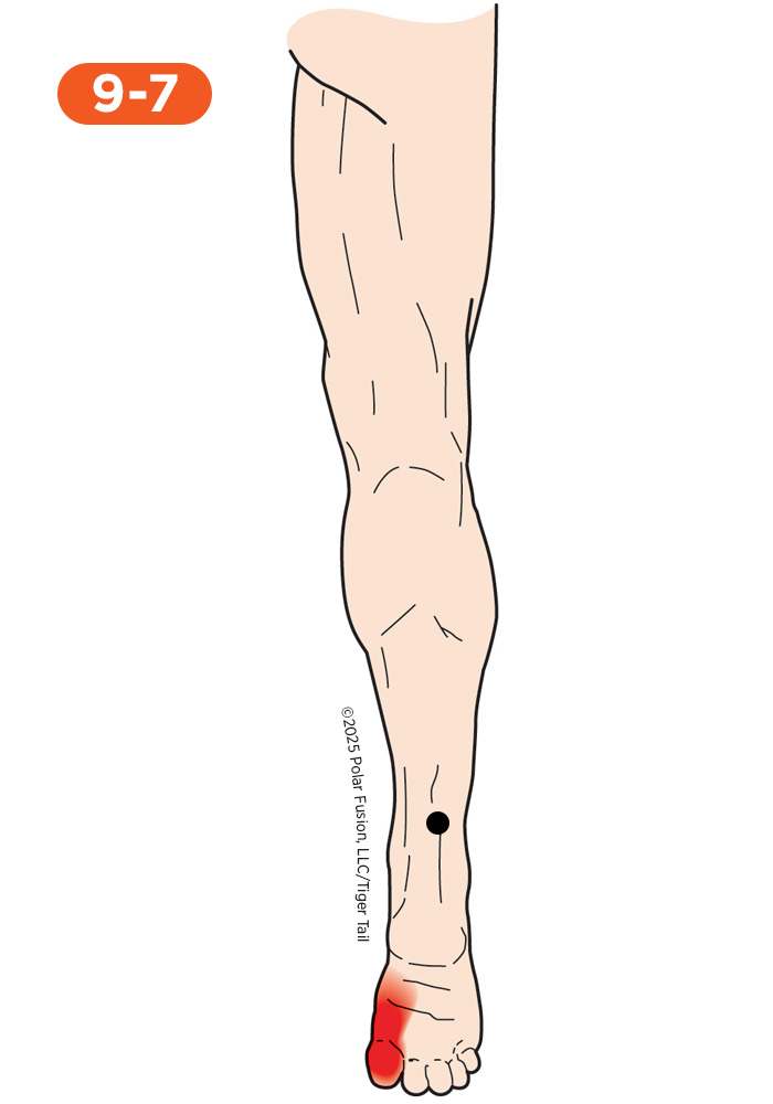 Foot and Toe Pain 9-7 Flexor Hallucis Longus