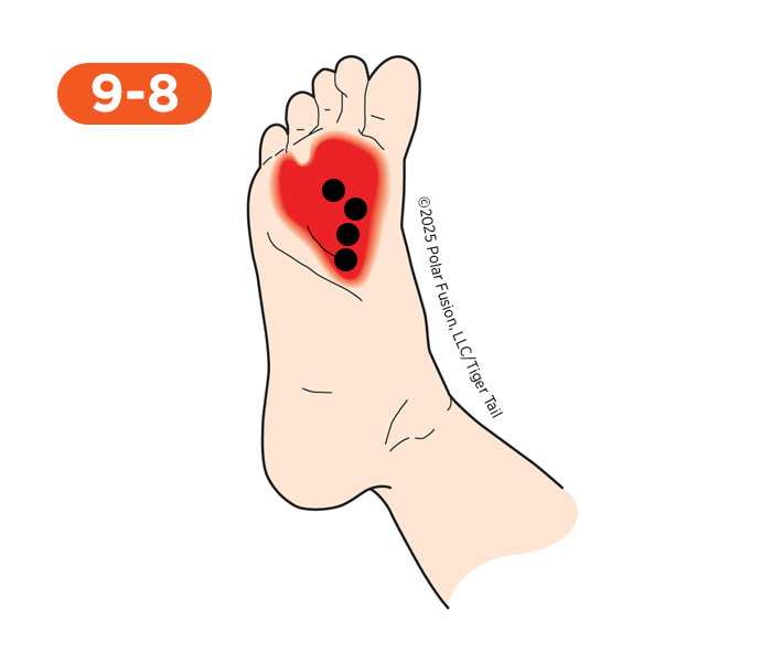 Foot and Toe Pain 9-8 Adductor Hallucis