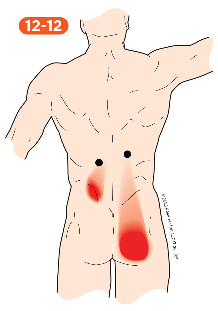 Glute Pain 12-12 Longissimus Thoracis
