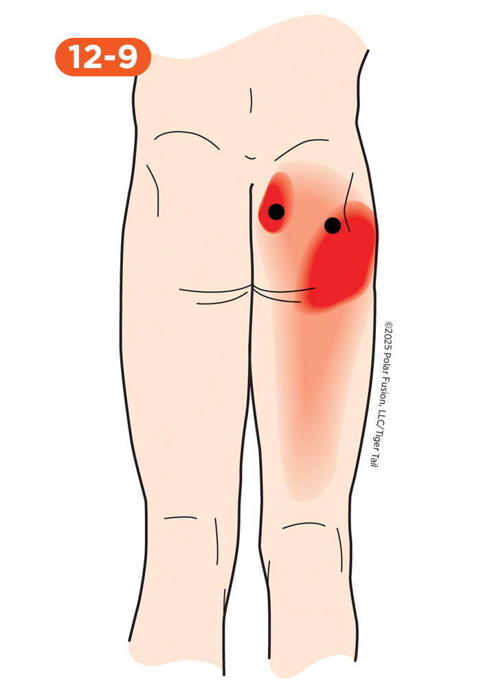 Glute Pain 12-9 Piriformis