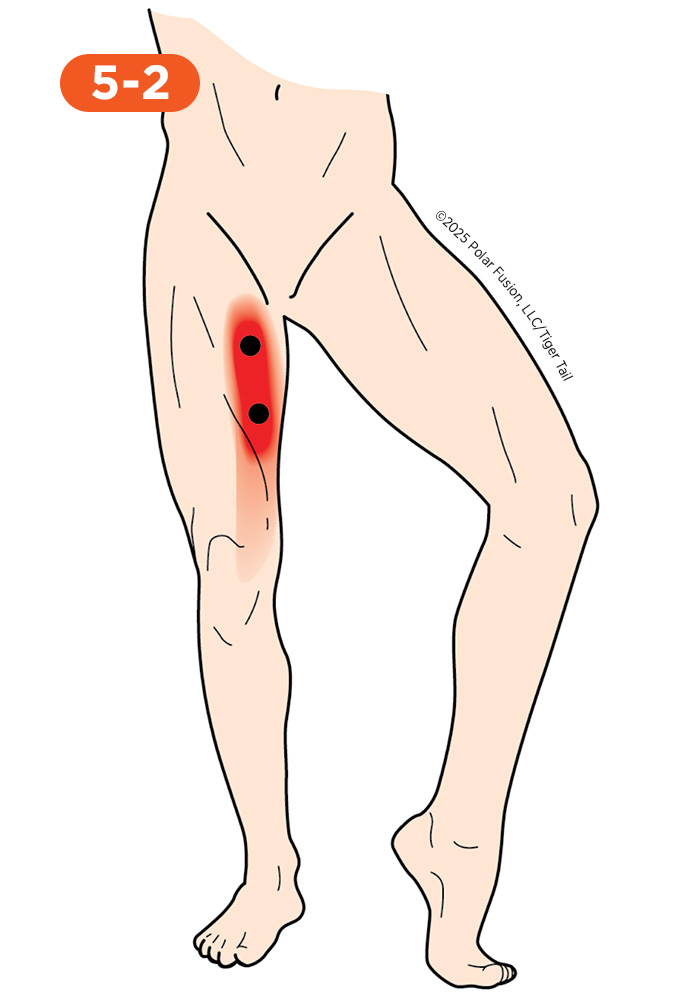 Inner Leg and Groin Pain 5-2 Gracilis