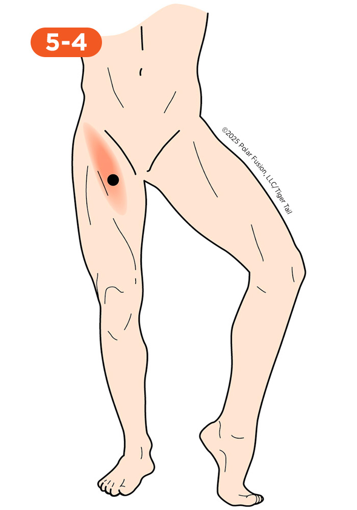 Inner Leg and Groin Pain 5-4_Sartorius