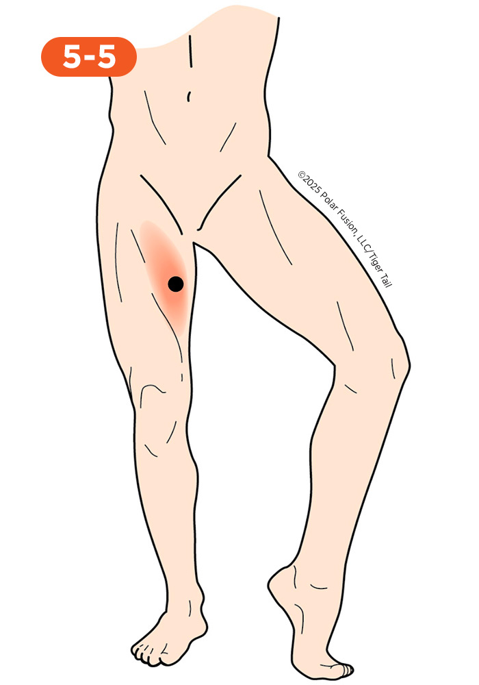 Inner Leg and Groin Pain 5-5 Sartorius