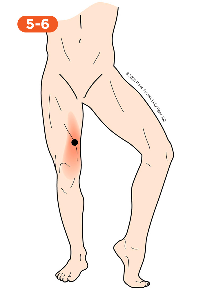 Inner Leg and Groin Pain 5-6 Sartorius