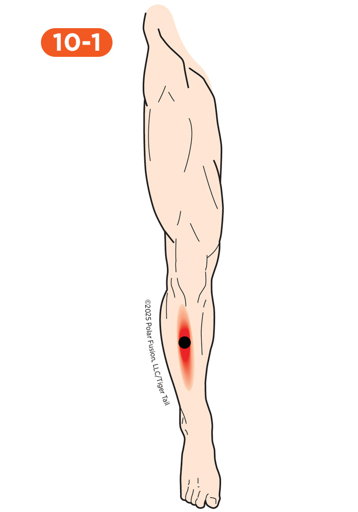 Shin Pain 10-1 Tibialis Anterior