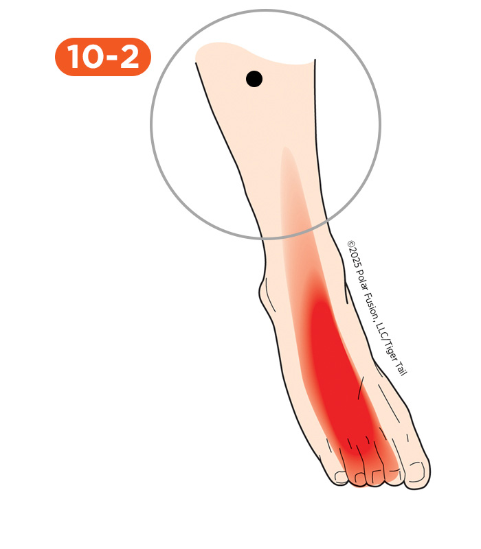 Shin Pain 10-2 Extensor Digitorum Longus