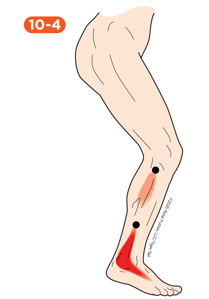 Shin Pain 10-4 Peroneus Longus (Upper) and Brevis (Lower)